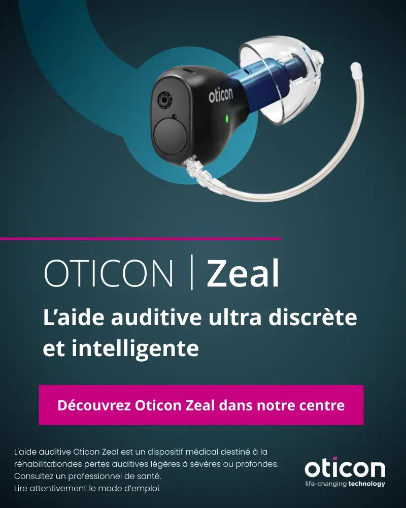 slide opticon